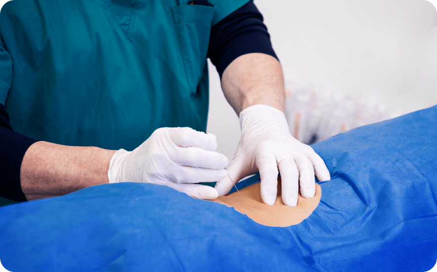 Facet Joint Injections