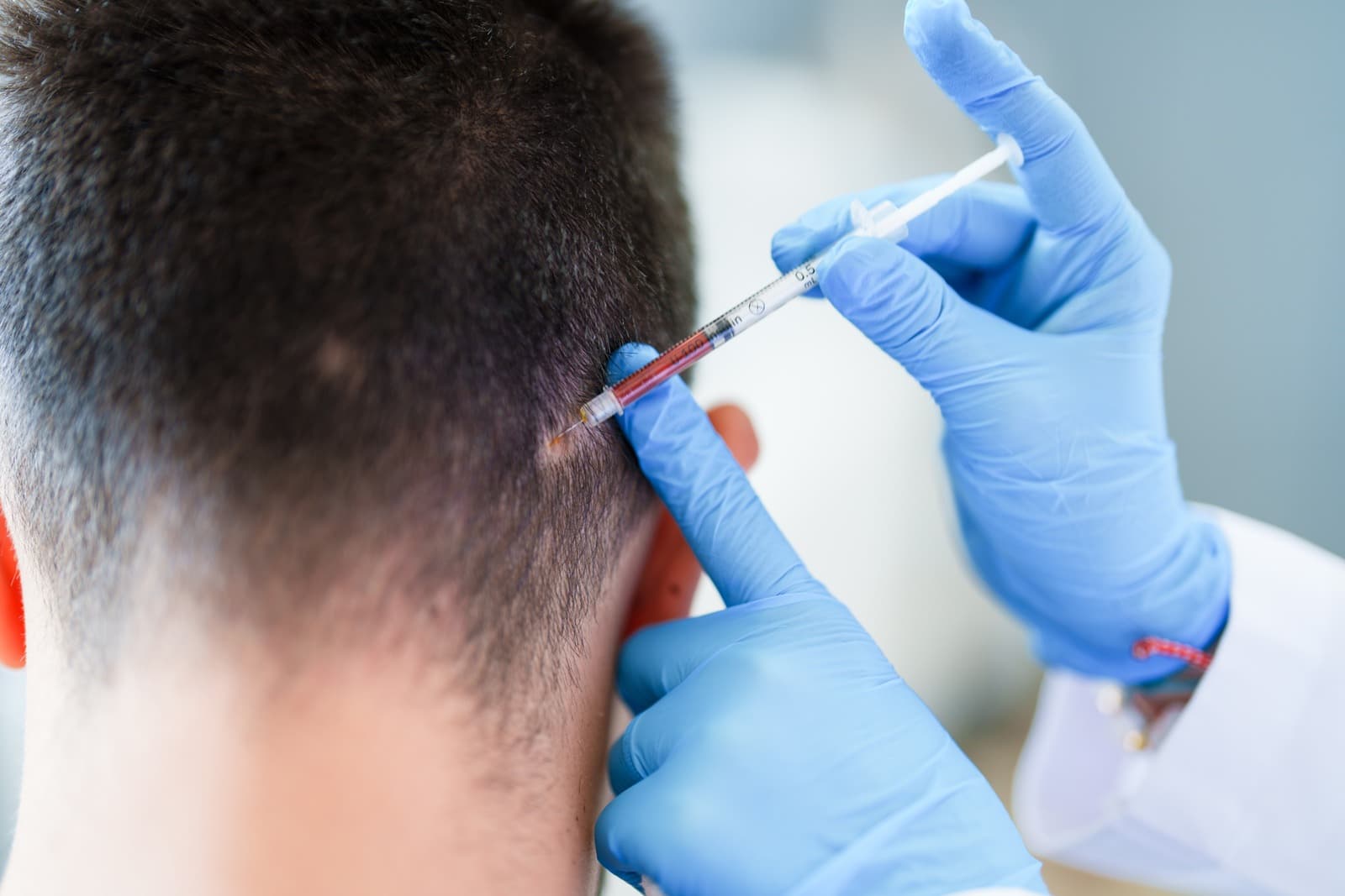 Occipital Nerve Blocks