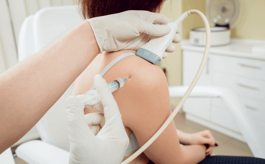 Subacromial / Subdeltoid Bursa Injections